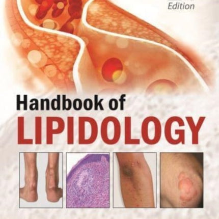 Handbook of Lipidology