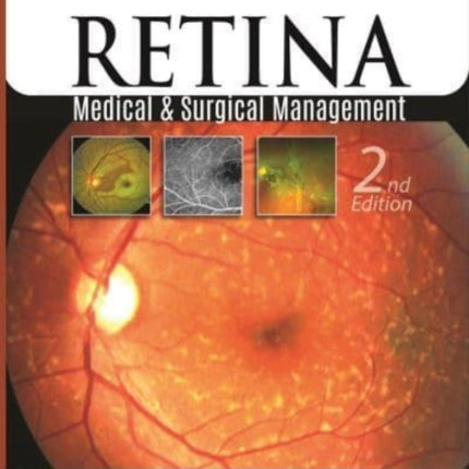 Retina: Medical & Surgical Management