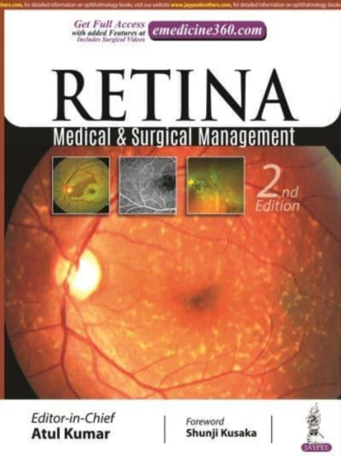 Retina: Medical & Surgical Management