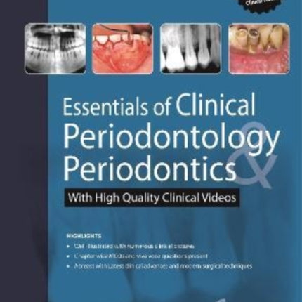 Essentials of Clinical Periodontology &