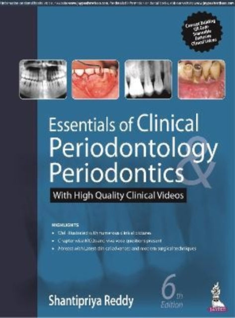 Essentials of Clinical Periodontology &