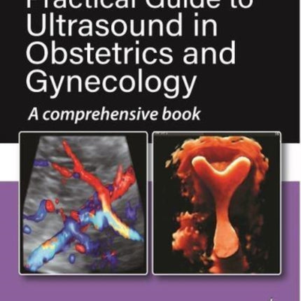 Practical Guide to Ultrasound in Obstetrics and