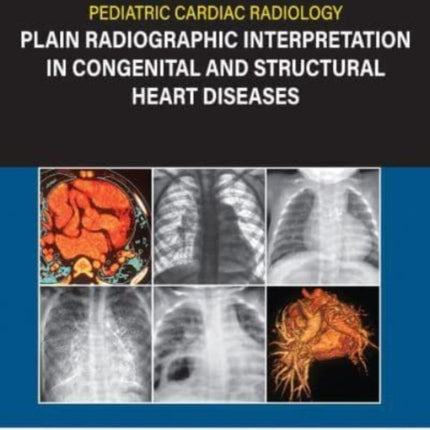 Pediatric Cardiac Radiology: Plain Radiographic Interpretation in Congenital and Structural Heart Diseases