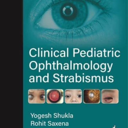 Clinical Pediatric Ophthalmology and Strabismus