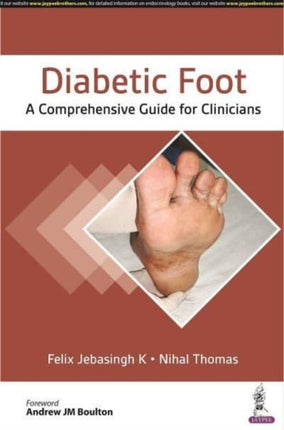Diabetic Foot: A Comprehensive Guide for