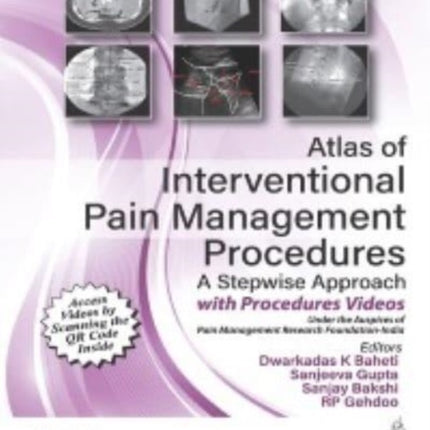 Atlas of Interventional Pain Management