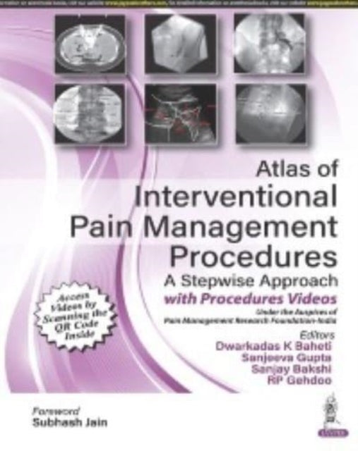 Atlas of Interventional Pain Management