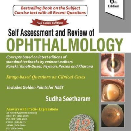 Self Assessment & Review of Ophthalmology