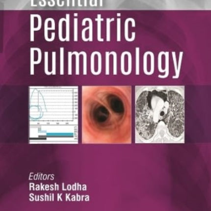 Essential Pediatric Pulmonology