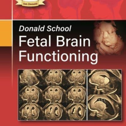 Donald School Fetal Brain Functioning