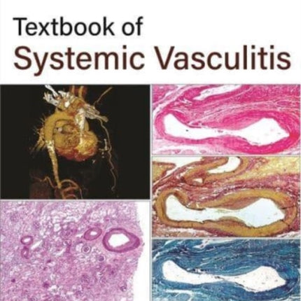 Textbook of Systemic Vasculitis
