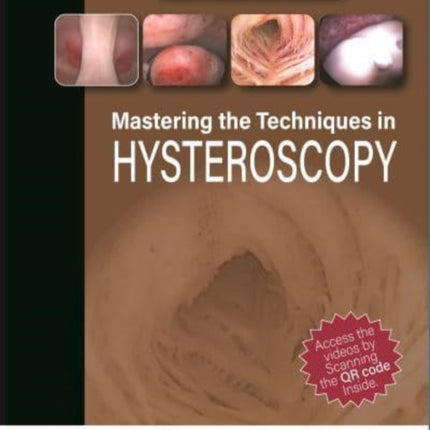 Mastering the Techniques in Hysteroscopy