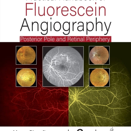 Practical Handbook of Fluorescein Angiography: