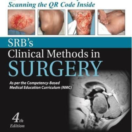 SRB's Clinical Methods in Surgery