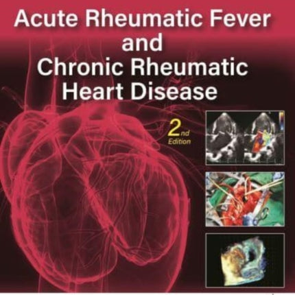 Acute Rheumatic Fever and Chronic Rheumatic Heart