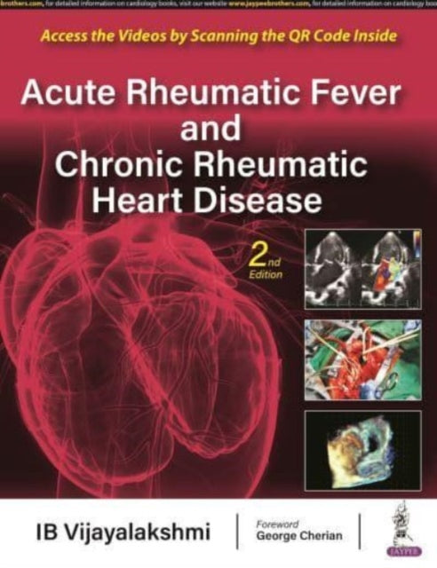 Acute Rheumatic Fever and Chronic Rheumatic Heart