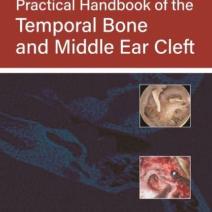 Practical Handbook of the Temporal Bone and