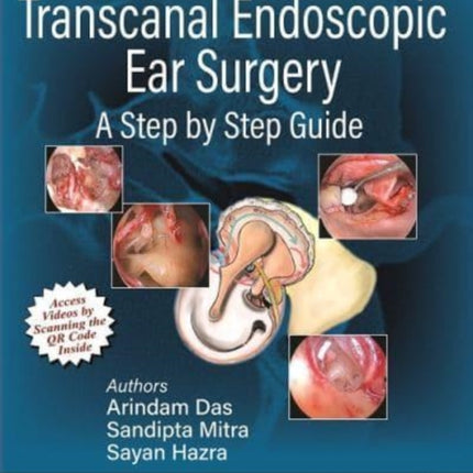 Surgical Atlas of Transcanal Endoscopic Ear