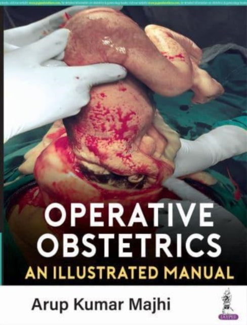 Operative Obstetrics: An Illustrated Manual