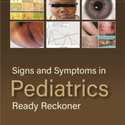 Signs and Symptoms in Pediatrics: Ready Reckoner