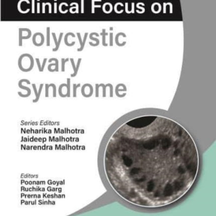 Clinical Focus on Polycystic Ovary Syndrome