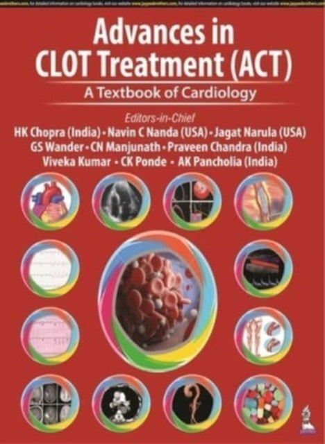 Advances in CLOT Treatment (ACT): A Textbook of Cardiology