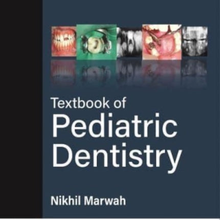 Textbook of Pediatric Dentistry