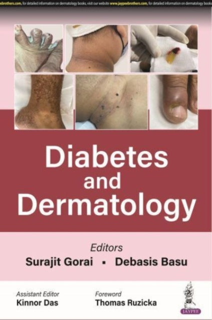 Diabetes and Dermatology