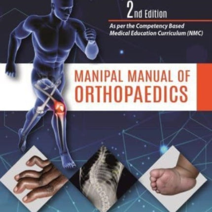 Manipal Manual of Orthopaedics