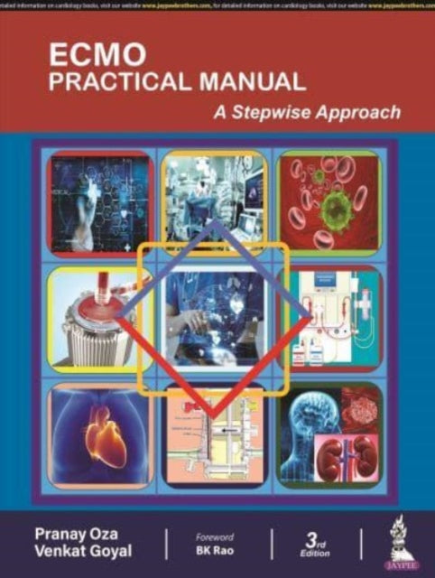 ECMO Practical Manual: A Stepwise Approach