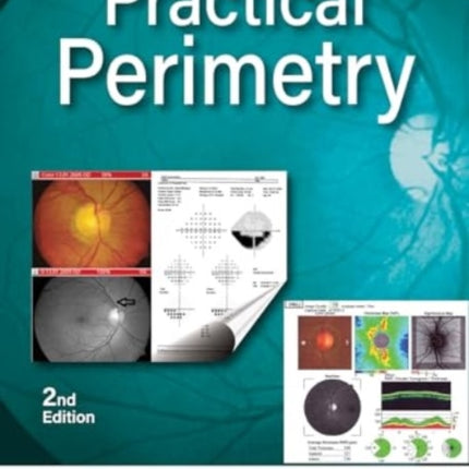 Practical Perimetry
