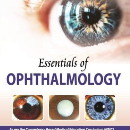 Essentials of Ophthalmology