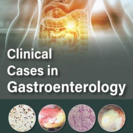 Clinical Cases in Gastroenterology