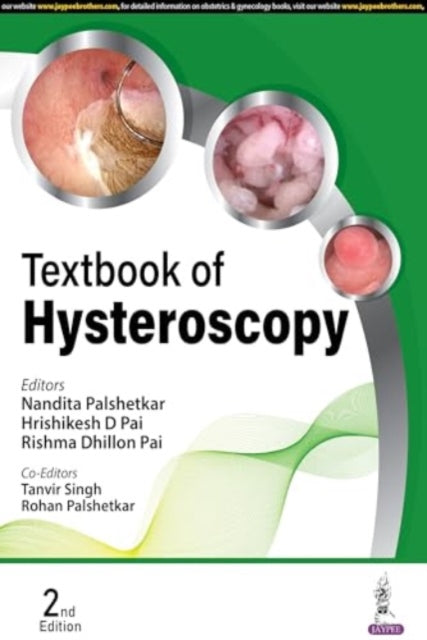 Textbook of Hysteroscopy