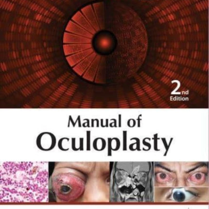 Manual of Oculoplasty