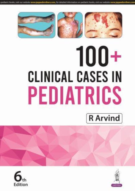 100 Clinical Cases in Pediatrics