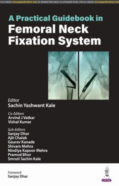 A Practical Guidebook in Femoral Neck Fixation