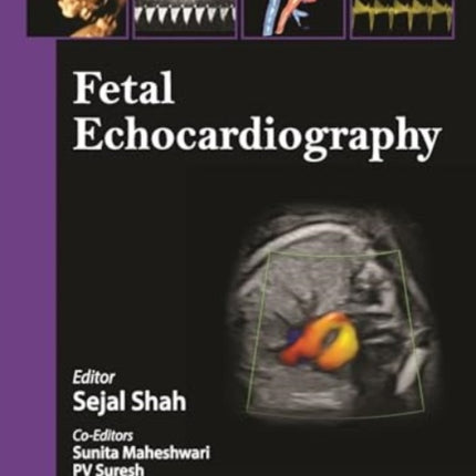 Fetal Echocardiography