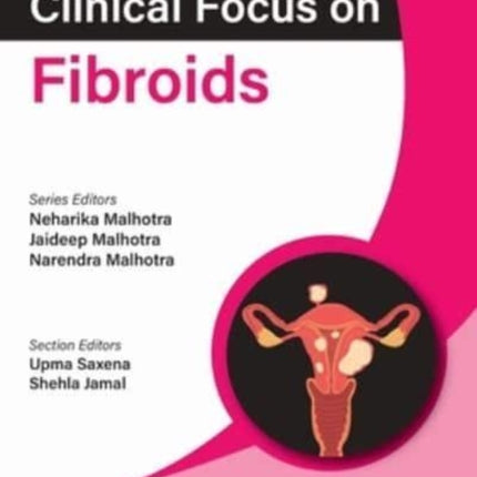 Clinical Focus on Fibroids