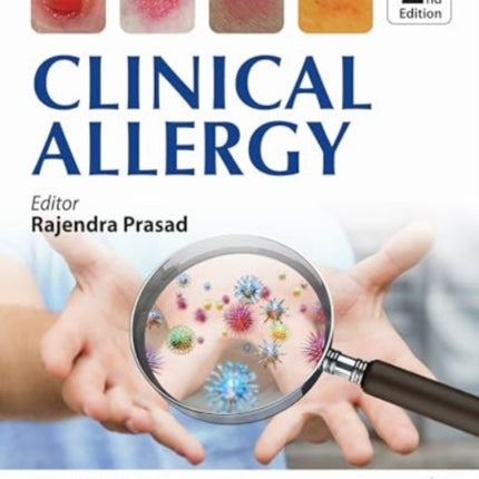 Clinical Allergy