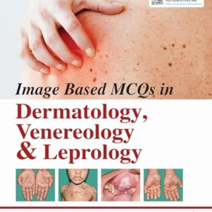 Image Based MCQs in Dermatology Venereology
