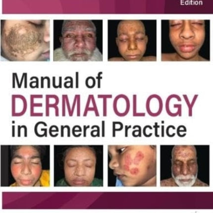 Manual of Dermatology in General Practice