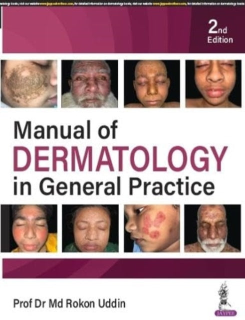 Manual of Dermatology in General Practice