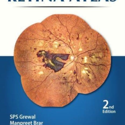 Retina Atlas