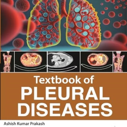 Textbook of Pleural Diseases