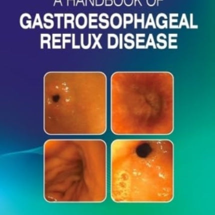 A Handbook of Gastroesophageal Reflux Disease