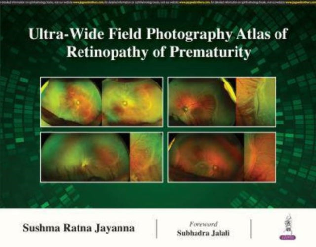 UltraWide Field Photography Atlas of Retinopathy of Prematurity