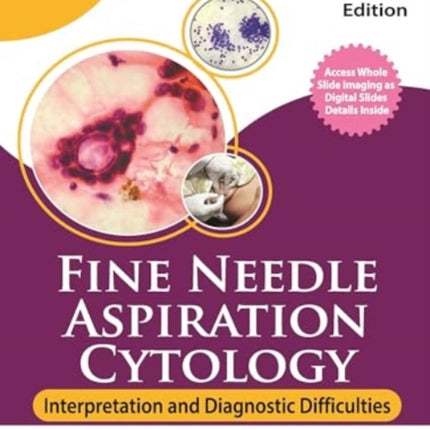 Fine Needle Aspiration Cytology: Interpretation