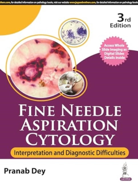 Fine Needle Aspiration Cytology: Interpretation