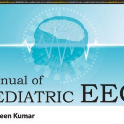 Manual of Pediatric EEG